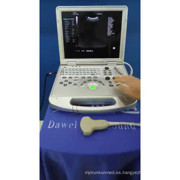 DW-C60PLUS máquinas clínicas para medicina y escáner de ultrasonido china
